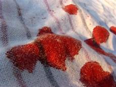 Wet Towel